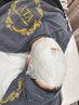 【フェイシャル/平日限定】話題の小顔!石膏パック 20％Off ¥5600