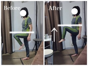 エイル(EIR)/50代女性　股関節の柔軟、腰痛