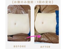 ネオボディ(Neo Body)の雰囲気（初回から効果を実感♪驚きの効果をご体感ください！）