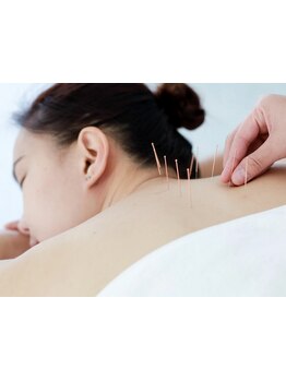 首・肩のつらさを改善したい