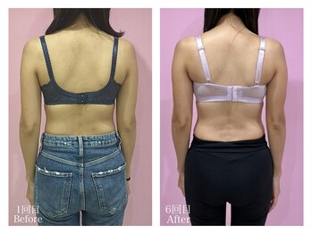 ククナ(KUKUNA)/*姿勢矯正*