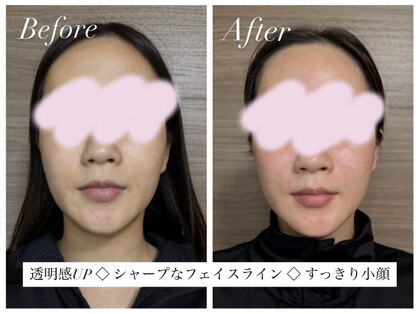 ヨサパーク リリア 立川北口店(YOSA PARK Lylia)の写真