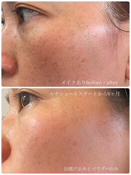 ペリドット(Peridot)/ルナシューネ化粧品