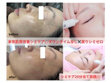 クリスタル(Crystal)