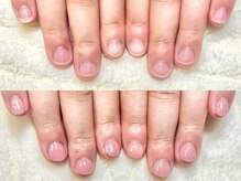 深爪矯正 爪悩み専門店 グラシナ 西宮北口店【4/3 NEW OPEN（予定）】/