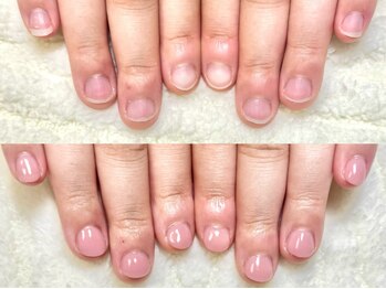 深爪矯正 爪悩み専門店 グラシナ 西宮北口店【4/3 NEW OPEN（予定）】/