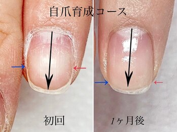トゥインクリーネイルサロン(Twinkly Nail Salon)/【地爪育成】1回お試し