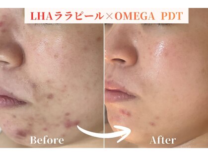 リラ 郡山店(Lilas)の写真