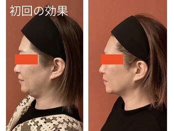 ロイヤリティ(ROYALTY)/アゴ下のお肉が気になる!