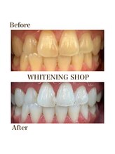 ホワイトニングショップ 札幌(Whitening Shop)/