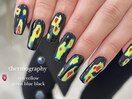 thermography