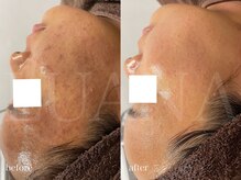 ルアナ(LUANA)/VOSサロンケア