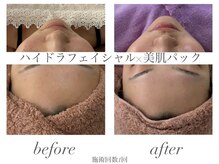 エミナル(EMINAL)/毛穴洗浄＋トーンアップパック