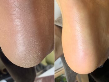 ニコ(niko)の写真/【新河岸駅から徒歩10分】爪のトラブルは当店にお任せください◎周りを気にせずゆったりと施術頂けます！