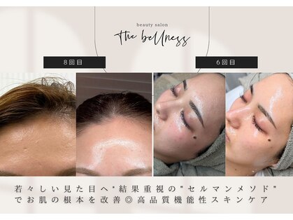 ザ ベルネス(The bellness)の写真