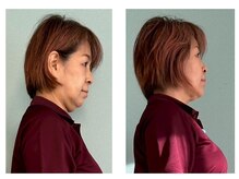 テルケル 佐賀/