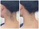 アロンジェファム(allonge femme)の写真