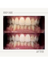 ホワイトニングビューティー 鯖江店(WHITENING BEAUTY)/初回30分照射コース