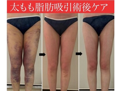 ミル(miru)の写真