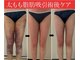 ミル(miru)の写真