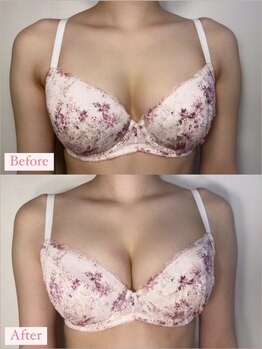 アンシャンテ(ENCHANTER)/光バストアップ