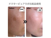 ルル(LULU)の雰囲気（肌が変わると気持ちも変わります）