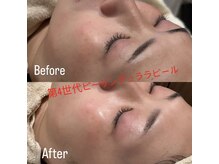トレア(TREA)の雰囲気（第4世代ピーリング！韓国肌管理ララピールで素肌美人！）