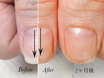 トゥインクリーネイルサロン(Twinkly Nail Salon)/【最強のネイルケア】1回お試し