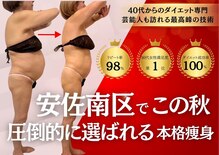 ヴィアス(VIAS)