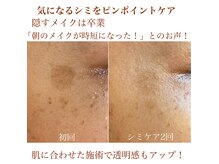 カミーシャ(KaMi-Sha)の雰囲気（くすみも一緒に明るく♪育つシミは早めのケアをしましょ☆）