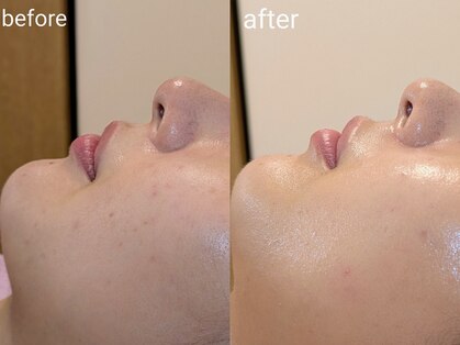 シャリル(charire)の写真