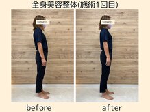 ヴィーネス(VIENESS)の雰囲気（【全身美容整体＋骨盤矯正】姿勢改善したい方にオススメ◎）