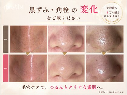 フロラスキン 心斎橋店(florasKIN)の写真