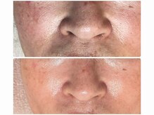ボディメイキング キキ(Bodymaking KIKI)の雰囲気（毛穴・シミケア・幹細胞トリートメントなどエイジングケアに特化）