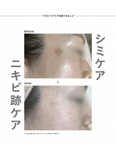 ミレラ(Mirela)/シミ色ムラを根本ケア！透明感UP