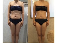 チャマ 高知店(CHAMA)/痩身をしたい方必見！