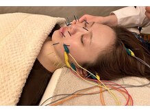 デルタエヌピー63+(δnp63+)/小顔電気鍼[薬院/フェイシャル]