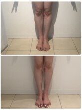 美人バスト 川崎店/【痩身・ダイエット】 川崎/脚☆