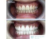 ファッシモ(fascimo)/お客様のBefore→After