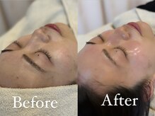 ザ パールズ(The Pearls)/透明感溢れる素肌へ