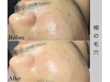 ブラックボックス(BLACK BOX)/30代男性のお客様