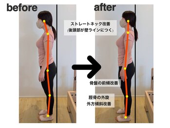 エクセル 藤が丘店(excel)/姿勢ビフォーアフター☆