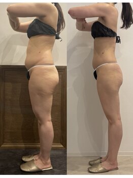 パリスヒロトン(PARIS HIROTON)/6ヶ月で－12kg &nbsp;(30代)