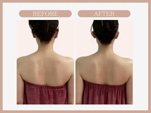 スリムライン 山形店(The Slim Line)/before→after