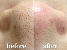 ラティエル(Latiele)の雰囲気(施術後に取れた汚れが見える!結果を出す無添加毛穴ケア!)