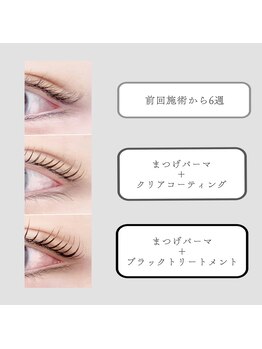 ロム フローラ(Rom Flora)/