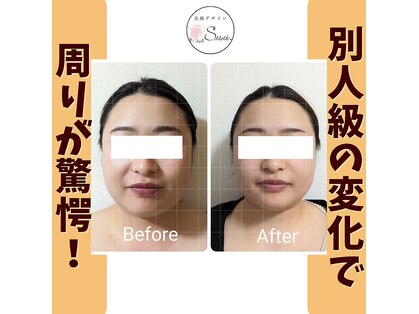 美顔デザインsuu.～若見えと歪み矯正専門の小顔サロン～の写真