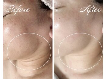 セレナータ(Serenata)の写真/《フェイシャルメニューを新たに導入予定☆》美肌を目指す美容女子必見!春の間に透明感あふれる水光肌へ♪