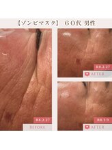 エクラ アン(eclat.un)/ゾンビマスク～５０代男性～