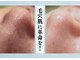 リヴェーヌ 富山店の写真/【大切なのは】毛穴洗浄！…だけでなく、毛穴が開く原因にアプローチ◎【リバウンドしないこと！】